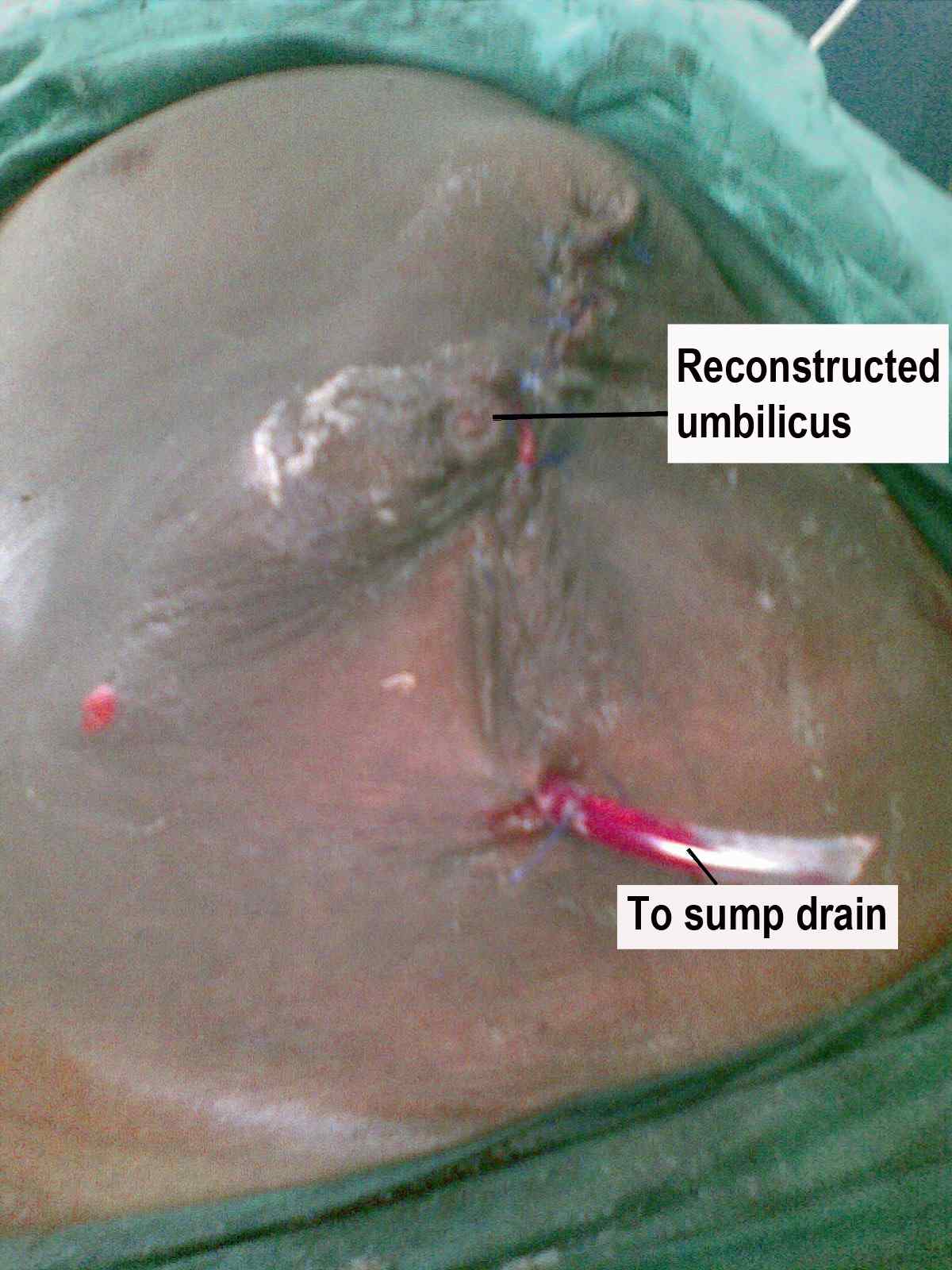 fig 3 f3